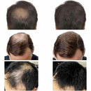 HairFiber Pro – Fibras de Cabelo com Queratina 27,5g